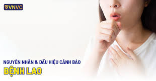 Bệnh lao là gì? Nguyên nhân và dấu hiệu cảnh báo bệnh lao